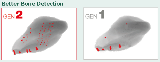 Comparison of detection performance between Gen1 ad Gen2.