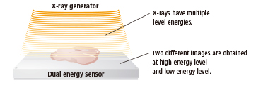 The dual energy inspection system