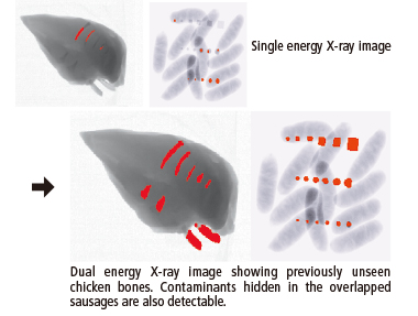 Dual energy X-ray Image