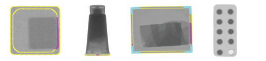 X-ray inspection image
